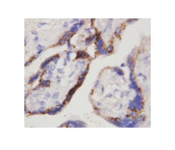 Beta-HCG Antibody