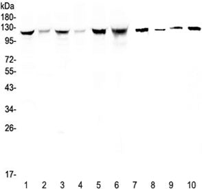 IDE Antibody / Insulin degrading enzyme