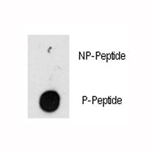 ILK Antibody (phospho-T173)