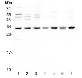SDHB Antibody