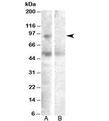 Western blot testing of human ovay lysate with SULF2 antibody at 0.3ug/ml with [B] and without [A] b