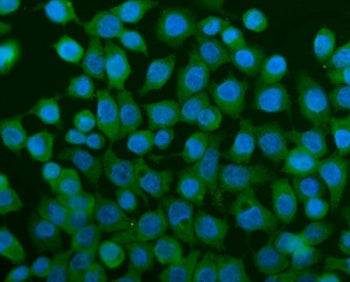 Immunofluorescent staining of FFPE human Caco-2 cells with TCP1 alpha antibody (green) and DAPI nucl