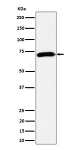 Western blot analysis of Choline Acetyltransferase expression in mouse brain cell lysate using CHAT 