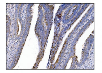 MerTK Antibody