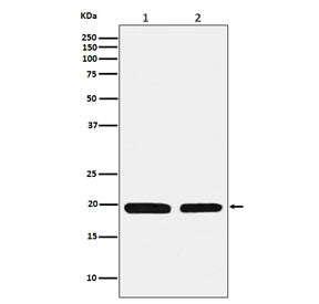 FTL Antibody / Ferritin light chain