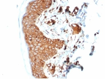 IHC staining of FFPE human skin with recombinant B2M antibody (clone B2M/7013R). HIER: boil tissue s