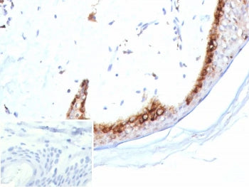 Kallikrein 4 Antibody / KLK4