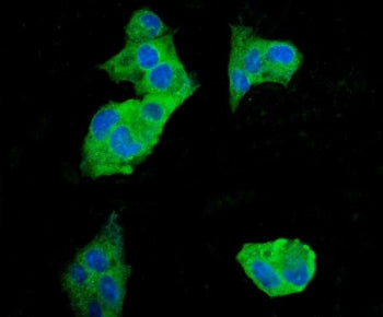Immunofluorescent staining of FFPE human HepG2 cells with EEF2 antibody (green) and DAPI nuclear sta