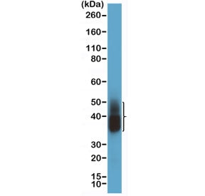 Napsin-A Antibody / NAPSA
