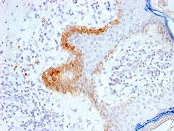 KRT15 Antibody / Cytokeratin 15