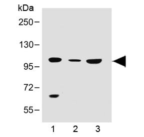 SLC14A2 Antibody (N-Terminal Region)
