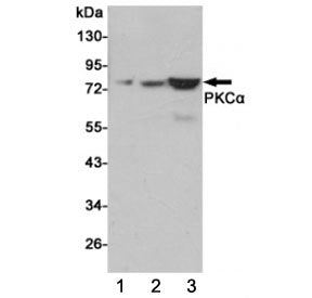 PRKCA Antibody / PKC alpha