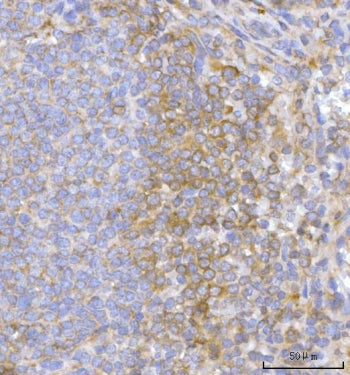 IHC staining of FFPE human spleen tissue with Hamartin antibody. HIER: boil tissue sections in pH8 E