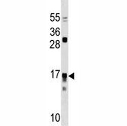 IL17RC Antibody