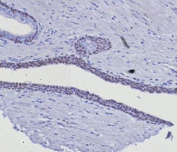 IHC staining of FFPE human prostate tissue with GATA-3 antibody (clone GATA3/8327R). HIER: boil tiss
