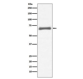 Alpha Fetoprotein / AFP Antibody