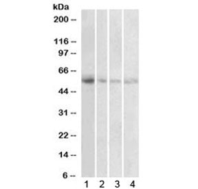 VMAT2 Antibody