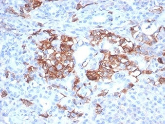 CD99 Antibody / MIC2