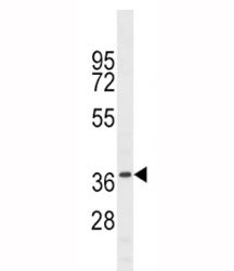 NKX6.1 antibody western blot analysis in mouse liver tissue lysate