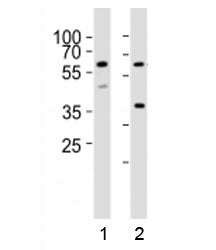 RIPK3 Antibody