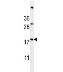 ACN9 Antibody / SDHAF3