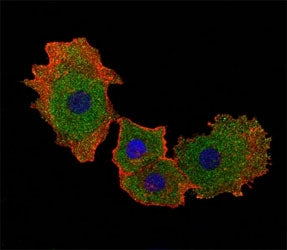 Fluorescent confocal image of MCF-7 cell stained with SMAD9 antibody at 1:25. SMAD9 immunoreactivity