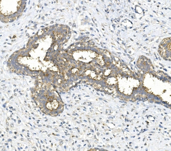 Gla Antibody / Galactosidase alpha