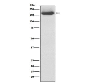 Neurofilament Antibody (-Medium) / NF-M / NEFM