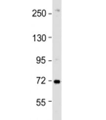 Western blot testing of HeLa cell lysate with ZDHHC17 antibody at 1:1000. Predicted molecular weight