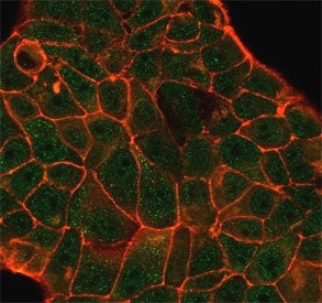 Immunofluorescent staining of PFA-fixed human MCF-7 using Decapping Protein 2 antibody (green, clone