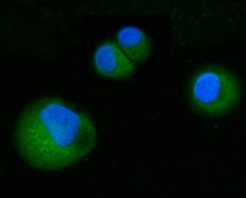 ABP1 Antibody / Amiloride binding protein 1 / AOC1