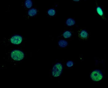 Immunofluorescent staining of FFPE human A549 cells with RGS12 antibody (green) and DAPI nuclear sta
