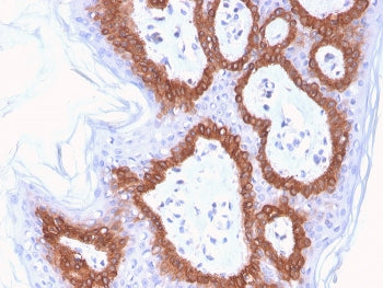 Cytokeratin 14 Antibody / CK14 / KRT14