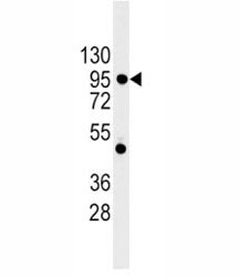 E Cadherin Antibody (CDH1)