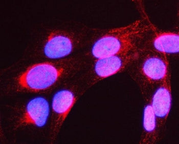 MYH16 Antibody / Myosin 16