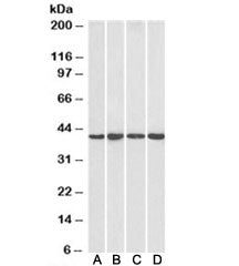 NIPP1 Antibody
