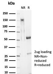 SDS-PAGE analysis of purified, BSA-free EpCAM antibody (clone EGP40/7025R) as confirmation of integr