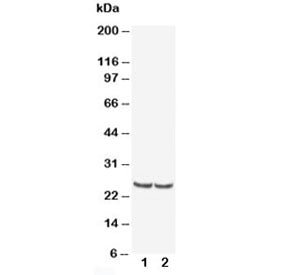 TIMP4 Antibody