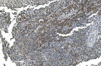 TIMM8A Antibody