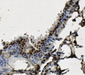 IHC staining of FFPE mouse lung with HNRNPD antibody. HIER: boil tissue sections in pH8 EDTA for 20 