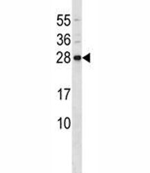 CD79b Antibody