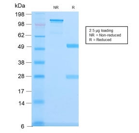 SDS-PAGE analysis of purified, BSA-free recombinant Spectrin beta III antibody (clone SPTBN2/3142R) 