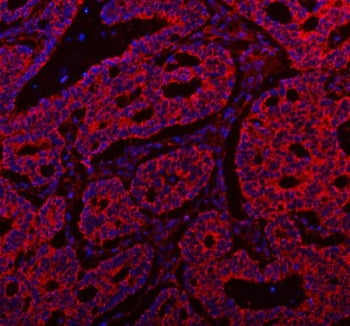 SSH3BP1 Antibody