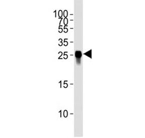 GFP Antibody / YFP