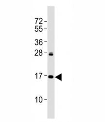 Western blot testing of p16INK4a antibody at 1:2000 dilution + HeLa lysate; Predicted molecular weig
