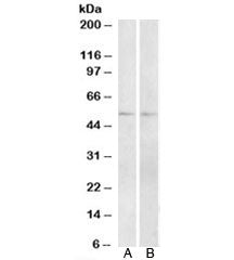 Western blot testing of A) mouse and B) rat small intestine lysate with Vipr1 antibody at 2ug/ml. Pr