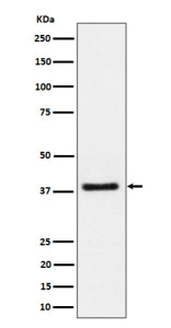 Western blot analysis of UCHL5IP/HAUS7 expression in human Jurkat cell lysate using HAUS7 antibody. 