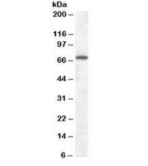 Cannabinoid Receptor Antibody