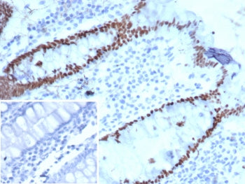 SATB2 Antibody