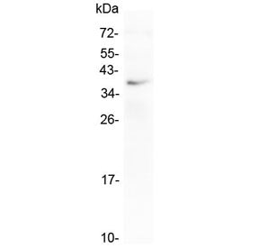 Western blot testing of human placental tissue with LOX-1 antibody at 0.5ug/ml. Predicted molecular 